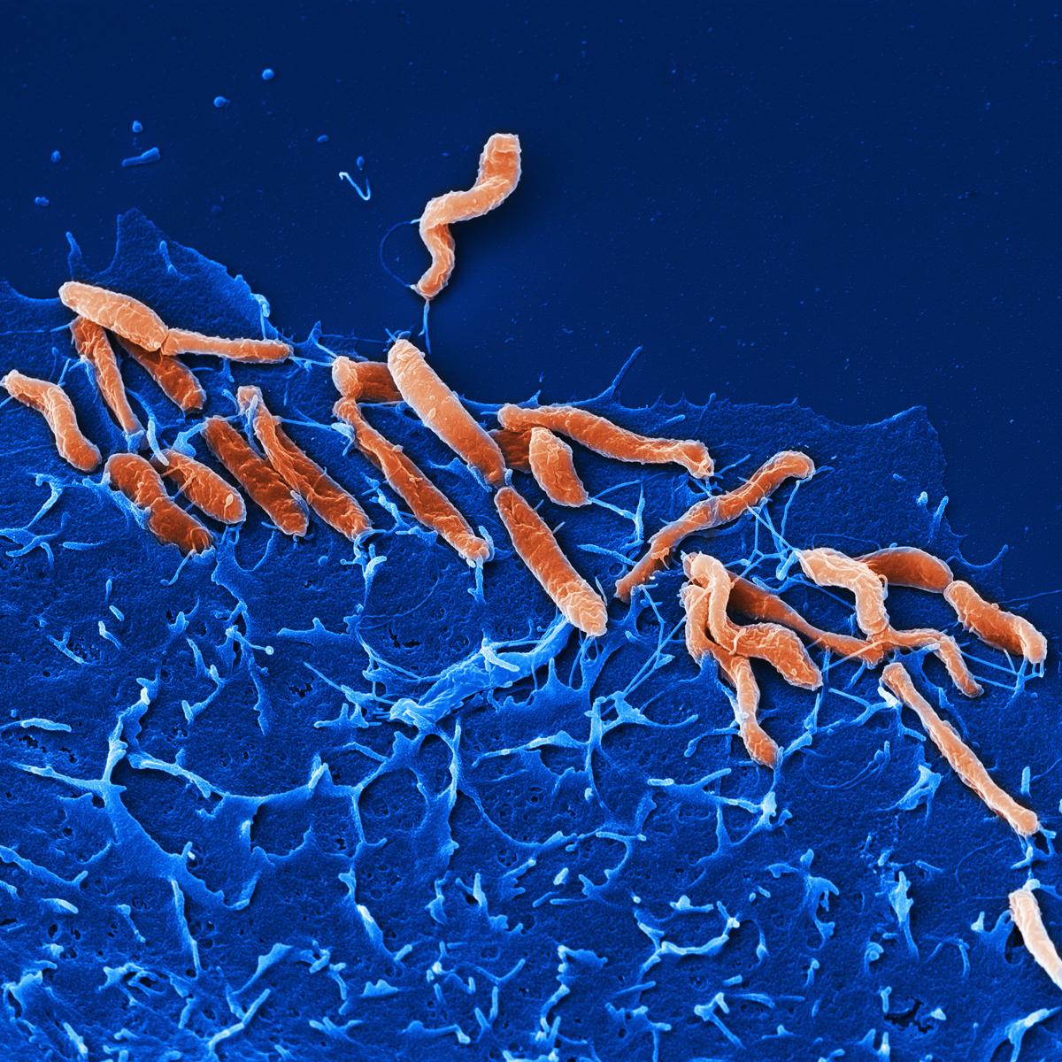 H. pylori povezana s rakom crijeva