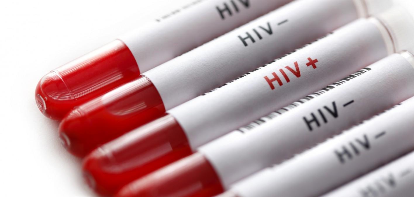 Uspješno blokira  vezivanje HIV-a za ćelije imunosnog sistema - Avaz