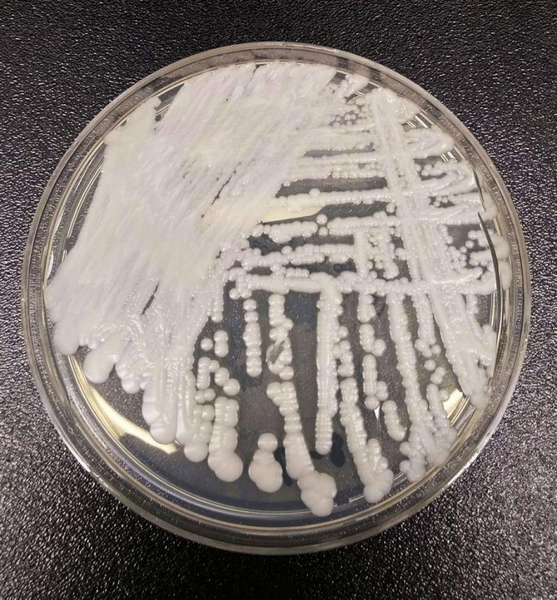 Candida auris fungus - Avaz