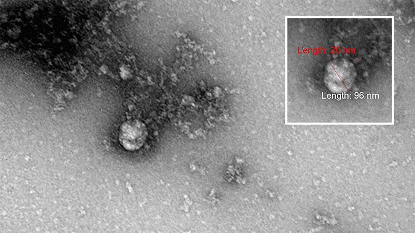Objavljena prva fotografija novog soja korona virusa