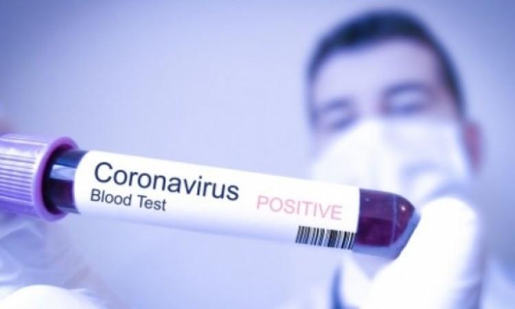 B&H registers 23 new coronavirus cases and four fatalities