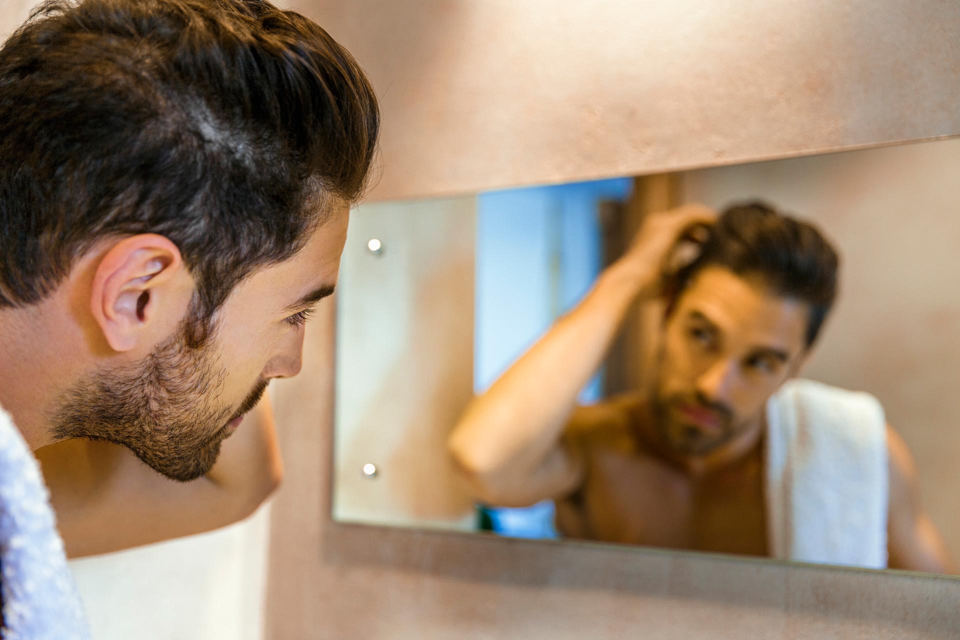 Androgena alopecija je najčešći tip ćelavosti - Avaz