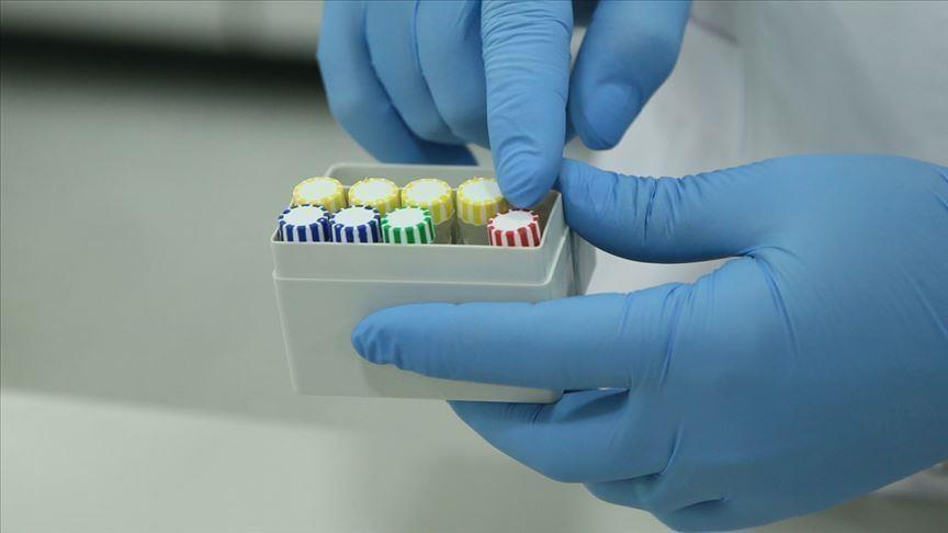 According to daily De Morgen, the surge in COVID-19 cases has pushed many private facilities in charge of processing PCR tests to seek help from the federal network of laboratories, especially in the Flanders region - Avaz