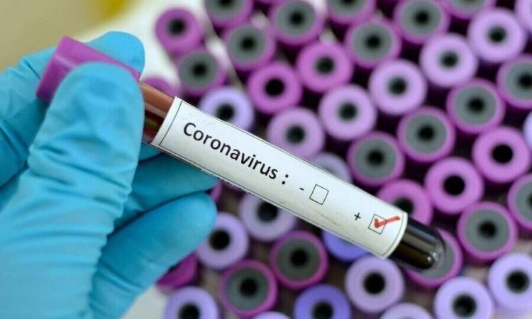 In Republic of Srpska coronavirus was confirmed in 74 people - Avaz