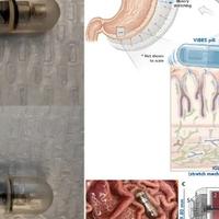 Je li pilula koja vibrira u želucu revolucija u borbi s viškom kilograma