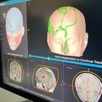 Zenički neurohirurzi obavili prvu operaciju tumora mozga: Upotreba uređaja za neuronavigaciju